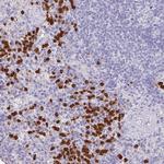 SH2D3C Antibody in Immunohistochemistry (Paraffin) (IHC (P))