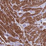 Creatine Kinase MM Antibody in Immunohistochemistry (Paraffin) (IHC (P))