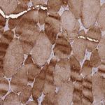 Creatine Kinase MM Antibody in Immunohistochemistry (Paraffin) (IHC (P))