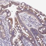 MRP3 Antibody in Immunohistochemistry (Paraffin) (IHC (P))