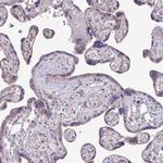 MRP3 Antibody in Immunohistochemistry (Paraffin) (IHC (P))