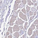 MRP3 Antibody in Immunohistochemistry (Paraffin) (IHC (P))