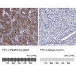 PTH Antibody