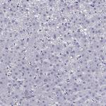 PTH Antibody in Immunohistochemistry (Paraffin) (IHC (P))