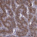 PTH Antibody in Immunohistochemistry (Paraffin) (IHC (P))