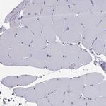 PTH Antibody in Immunohistochemistry (Paraffin) (IHC (P))