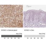 KCNQ1 Antibody