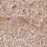 KCNQ1 Antibody in Immunohistochemistry (Paraffin) (IHC (P))