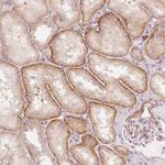 KCNQ1 Antibody in Immunohistochemistry (Paraffin) (IHC (P))