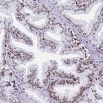 HDAC8 Antibody in Immunohistochemistry (Paraffin) (IHC (P))