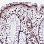 HDAC8 Antibody in Immunohistochemistry (Paraffin) (IHC (P))