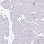 HDAC8 Antibody in Immunohistochemistry (Paraffin) (IHC (P))