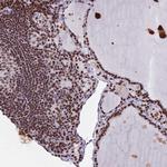 HDAC8 Antibody in Immunohistochemistry (Paraffin) (IHC (P))