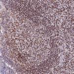 HDAC8 Antibody in Immunohistochemistry (Paraffin) (IHC (P))