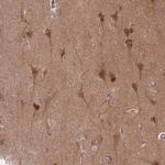 GUK1 Antibody in Immunohistochemistry (Paraffin) (IHC (P))