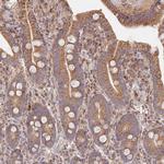 GUK1 Antibody in Immunohistochemistry (Paraffin) (IHC (P))