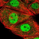 ESRP2 Antibody in Immunocytochemistry (ICC/IF)