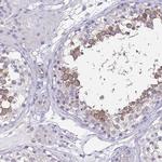 BOLL Antibody in Immunohistochemistry (Paraffin) (IHC (P))