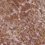 EPHX1 Antibody in Immunohistochemistry (Paraffin) (IHC (P))