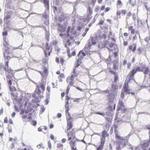 EPHX1 Antibody in Immunohistochemistry (Paraffin) (IHC (P))