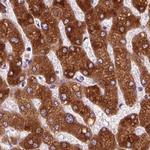 EPHX1 Antibody in Immunohistochemistry (Paraffin) (IHC (P))