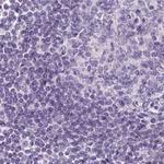 EPHX1 Antibody in Immunohistochemistry (Paraffin) (IHC (P))