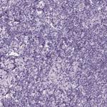 EPHX1 Antibody in Immunohistochemistry (Paraffin) (IHC (P))