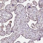 SLC5A5 Antibody in Immunohistochemistry (Paraffin) (IHC (P))