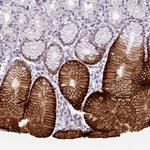 SLC5A5 Antibody in Immunohistochemistry (Paraffin) (IHC (P))