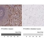 PYCARD Antibody