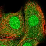 PYCARD Antibody in Immunocytochemistry (ICC/IF)