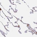 PYCARD Antibody in Immunohistochemistry (Paraffin) (IHC (P))