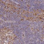 PYCARD Antibody in Immunohistochemistry (Paraffin) (IHC (P))