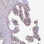 POLB Antibody in Immunohistochemistry (Paraffin) (IHC (P))