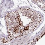 POLB Antibody in Immunohistochemistry (Paraffin) (IHC (P))