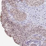 POLB Antibody in Immunohistochemistry (Paraffin) (IHC (P))