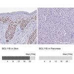 BCL11B Antibody