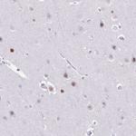 BCL11B Antibody in Immunohistochemistry (Paraffin) (IHC (P))