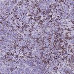 BCL11B Antibody in Immunohistochemistry (Paraffin) (IHC (P))