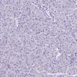 BCL11B Antibody in Immunohistochemistry (Paraffin) (IHC (P))