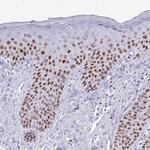 BCL11B Antibody in Immunohistochemistry (Paraffin) (IHC (P))