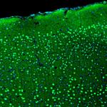 BCL11B Antibody in Immunohistochemistry (Paraffin) (IHC (P))