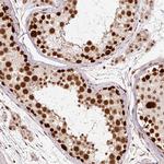 RFC4 Antibody in Immunohistochemistry (Paraffin) (IHC (P))