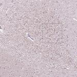 CNGA3 Antibody in Immunohistochemistry (Paraffin) (IHC (P))