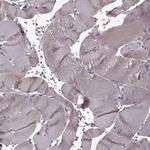 CNGA3 Antibody in Immunohistochemistry (Paraffin) (IHC (P))