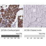 KIF13B Antibody