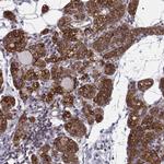 KIF13B Antibody in Immunohistochemistry (Paraffin) (IHC (P))