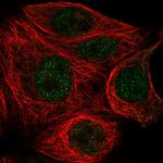 TBP Antibody in Immunocytochemistry (ICC/IF)