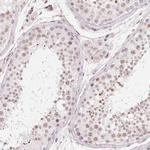 TBP Antibody in Immunohistochemistry (Paraffin) (IHC (P))