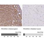 PACSIN2 Antibody